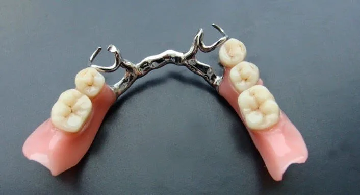 Брюгельные протезы